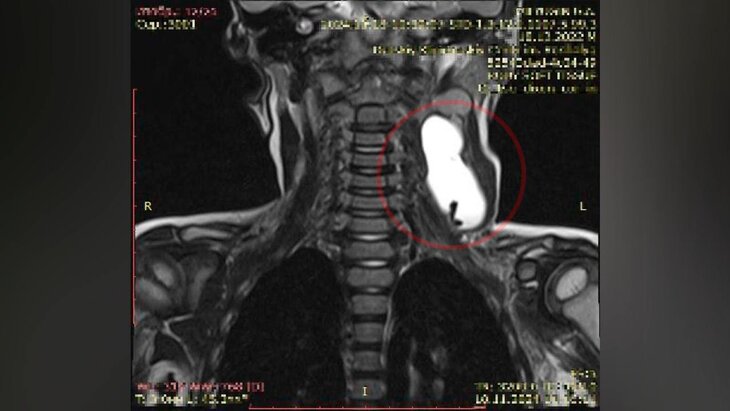 � ����������� ����� ������ ������� �� ���������� ����� �� ���