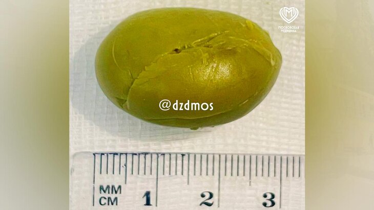 ����� � ������ ������ �������, � �������� � ������� �������� ������